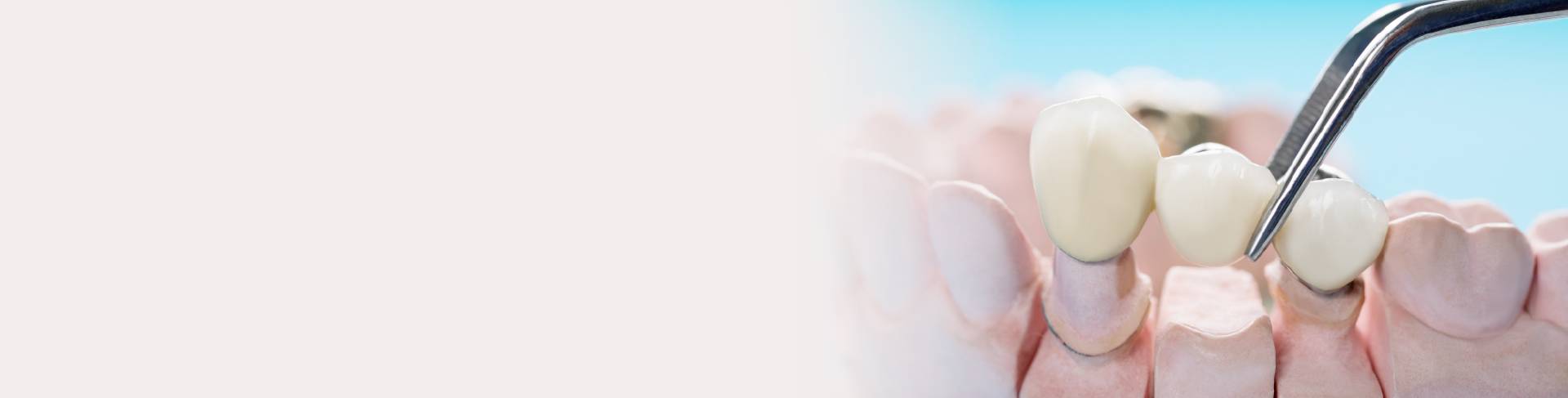 banner banner