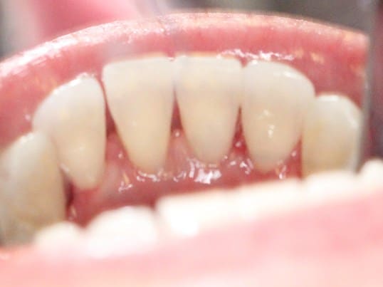In Needs of A Cleaning before treatment In Needs of A Cleaning before treatment