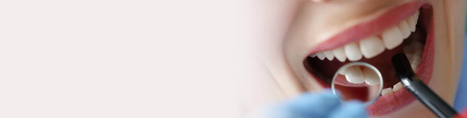 banner banner